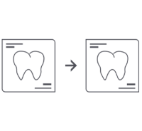 invisalign_vorher_nachher.png 