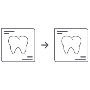 invisalign_vorher_nachher.png